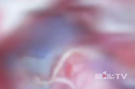 37岁男子突然头部失控不断点头