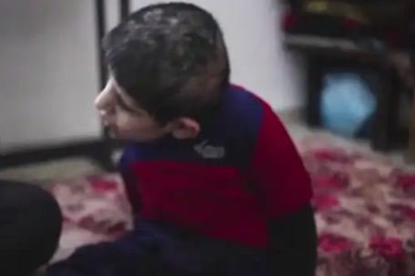 加沙15岁男孩饿到只剩18公斤