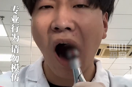 医学生自拔智齿 手起牙落面不改色