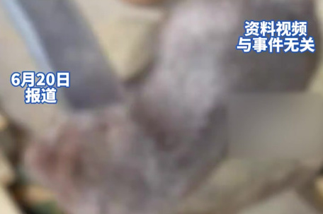 夫妻吃了来偷柑橘的竹鼠后双双肺炎 