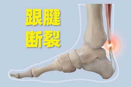 左氧氟沙星会让跟腱有断裂风险吗