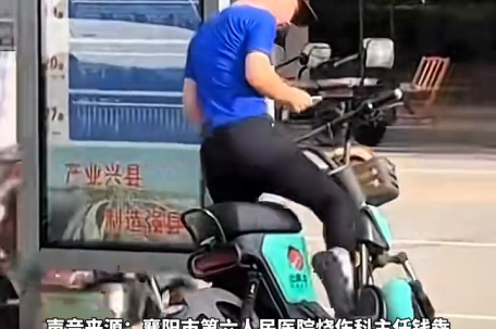 72岁老人坐石头10秒屁股竟烫糊了