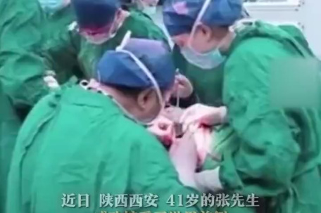 世界首例 腰上种牙再移植手术成功