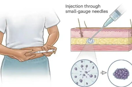 麻省理工研发新型避孕针 一针管数年