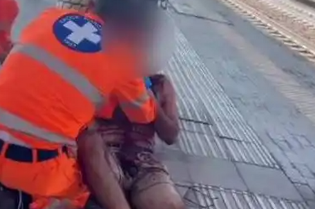 美游客戴金项链在米兰遭割喉抢劫