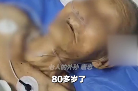 老人被毒蛇咬连打4支血清抢救脱险 