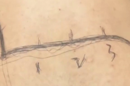 男生拍抽象视频被网友诊定脊柱隐裂