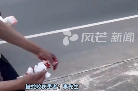 七旬老农被五步蛇咬后割肉放血自救 