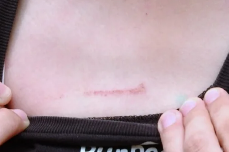 14岁女孩为护弟弟遭女子殴打