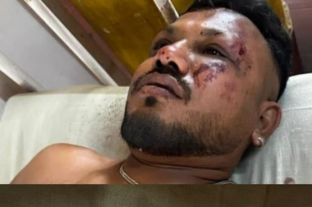 幸存者跳机逃生 自行从残骸中走出