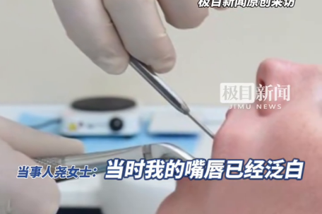 女子拔智齿后坐飞机创口高空爆血