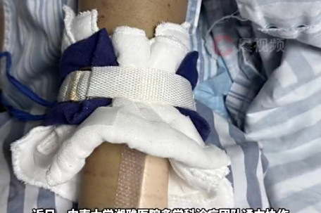 男子反复水肿11年后诱发致命病症