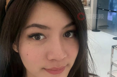 泰女子注射玻尿酸险毁容唇肿如香肠