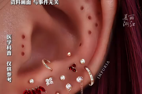 9块9的耳钉被查出镍超标61倍