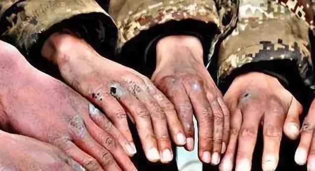 古代寒冷地区打仗,真的会冻掉士兵手指吗? 古代寒冷地区打仗,真的会冻掉士兵手指吗?
