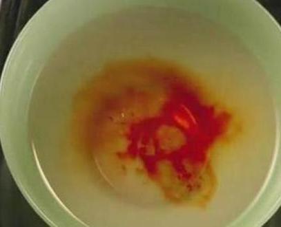 古时候的滴血认亲靠谱吗 这种方法有科学依据吗 古时候的滴血认亲靠谱吗 这种方法有科学依据吗