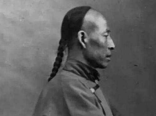 清朝规定男性都要留辫子，那秃顶和光头的人怎么办？