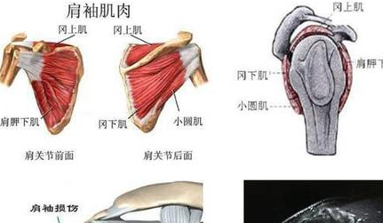 冻结肩的病因至今不明，一般认为与现代哪些疾病有关？